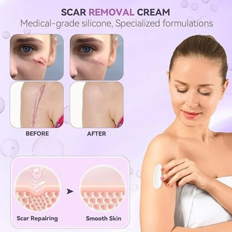 TIMILK Scarvanisher اسکار جیل 30 گرام | داغ دھبوں اور اسٹریچ مارکس کو ختم کرنے والی ایڈوانسڈ کریم | جلد کو ٹھیک کرنے والی تیزی سے جذب ہونے والی جیل